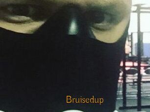 Bruisedup