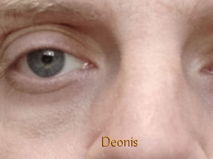 Deonis