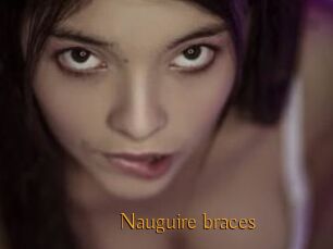 Nauguire_braces
